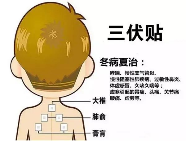 2、三伏貼的功能和功效是什么？