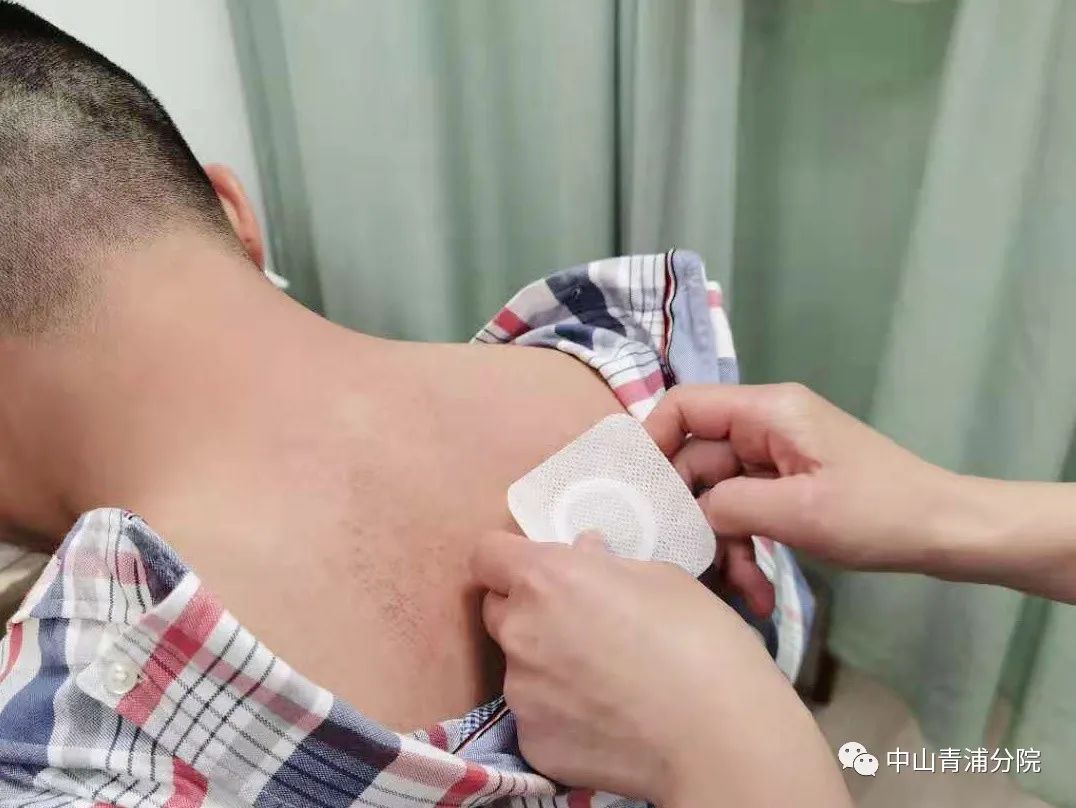 2、江西兒童貼三伏貼癢灼痛，什么體質(zhì)的人可以貼三伏貼癢灼痛？