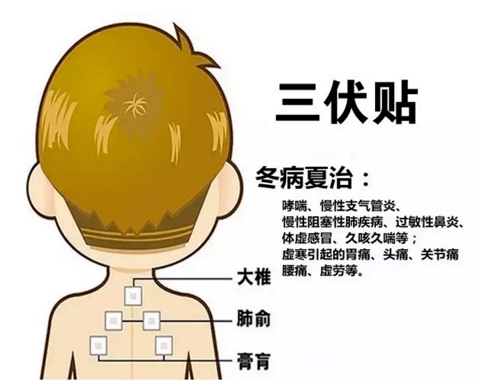 1、三伏貼多大？寶寶能貼多少？</p><p>三伏貼孩子貼多久？