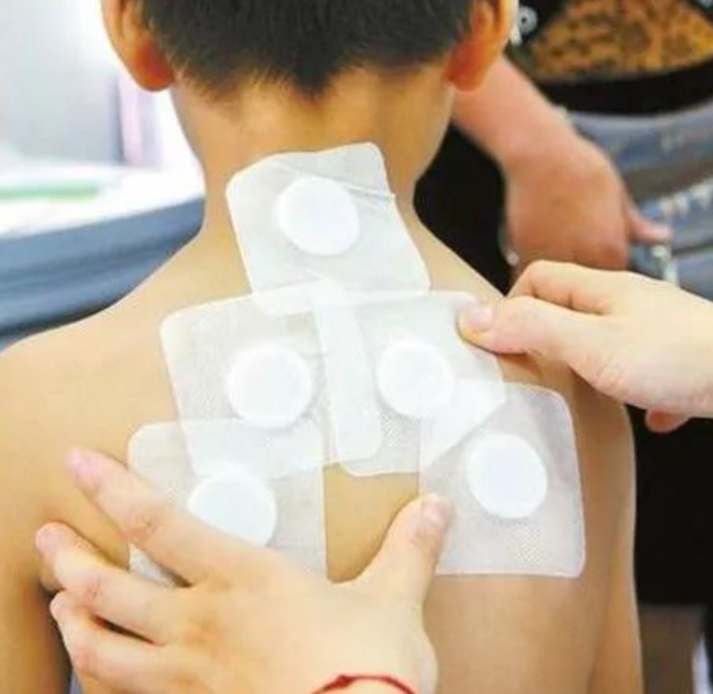 2、三伏貼在脖子上，有一根針，看起來(lái)很疼。怎么了